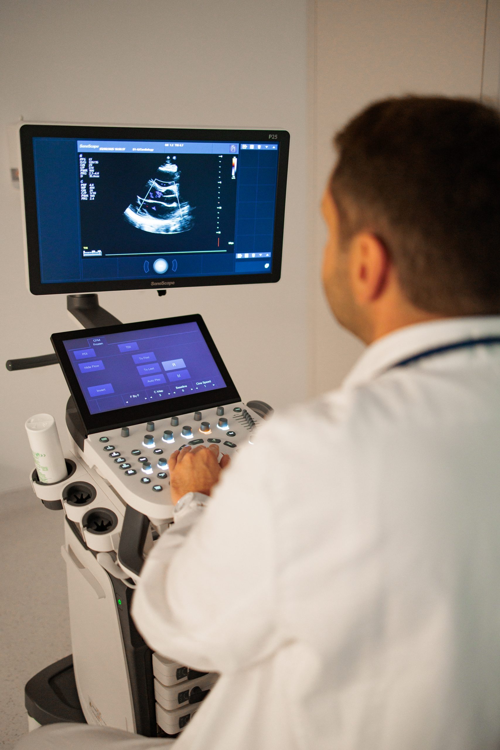 Zdravstveni djelatnik u bijeloj kuti upravlja ultrazvučnim aparatom, dok se na gornjem monitoru prikazuje crno-bijeli sonogram u kliničkoj ordinaciji.