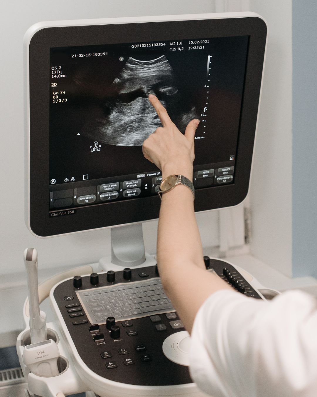 Ruka pokazuje na ultrazvučnu snimku na monitoru uz kontrole i sondu aparata.