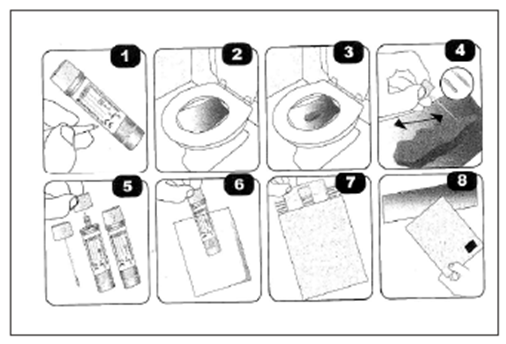 Upute u 8 koraka za uzimanje uzorka stolice: priprema posudice, sakupljanje, označavanje i spremanje prema prikazanim slikama.