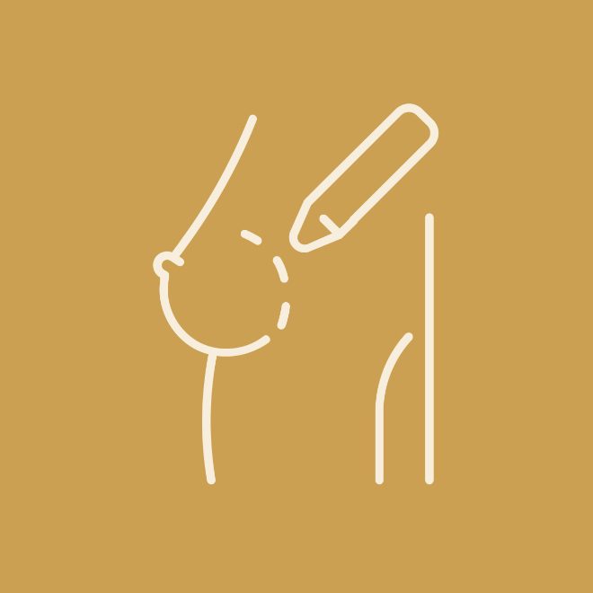 Kirurgija dojke u IMC Priora