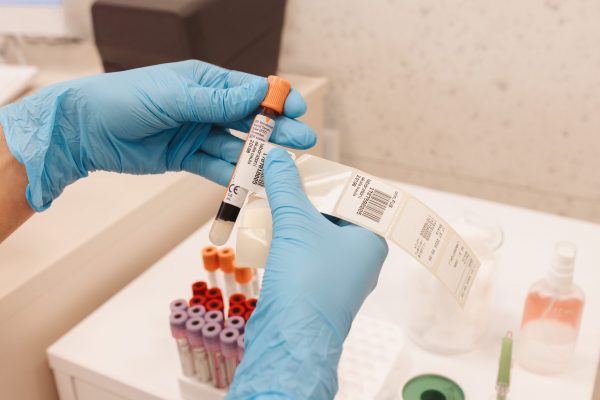 Osoba s plavim rukavicama drži epruvetu s krvlju i naljepnicom u laboratorijskom okruženju.
