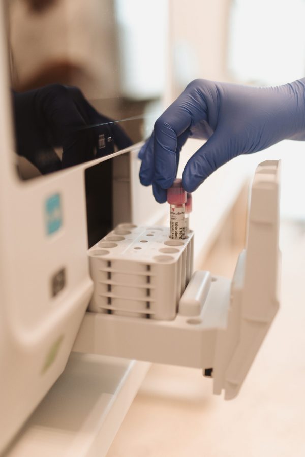 Osoba u plavoj rukavici stavlja epruvetu u laboratorijski uređaj.