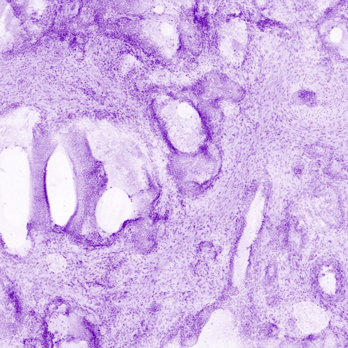 Mikroskopska slika tkivnog uzorka obojanog ljubičastim pigmentom, prikazuje strukturalne detalje stanica i međustaničnog prostora.