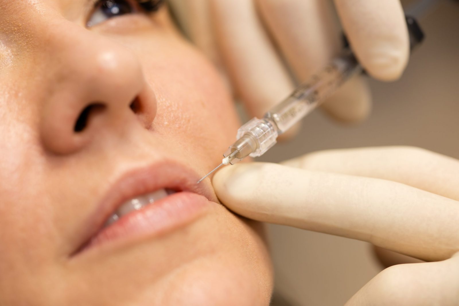 Close-up of gloved hands administering a syringe injection to a person’s lip during a cosmetic filler procedure.