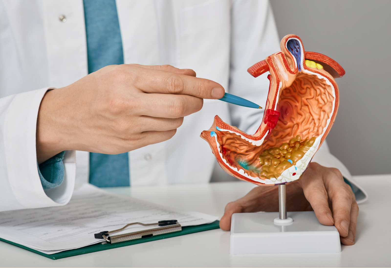 A healthcare professional in a white coat uses a pen to point at a cross-section stomach model on a stand, indicating a red area near the esophagus with a clipboard on the desk.