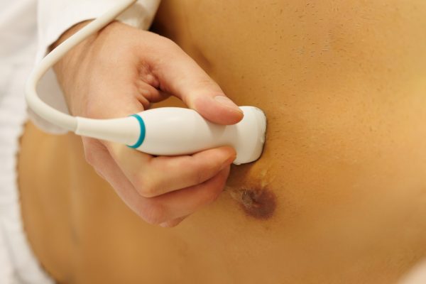 Ruka medicinskog djelatnika drži ultrazvučnu sondu na koži trupa, pored tamne upaljene kožne lezije.
