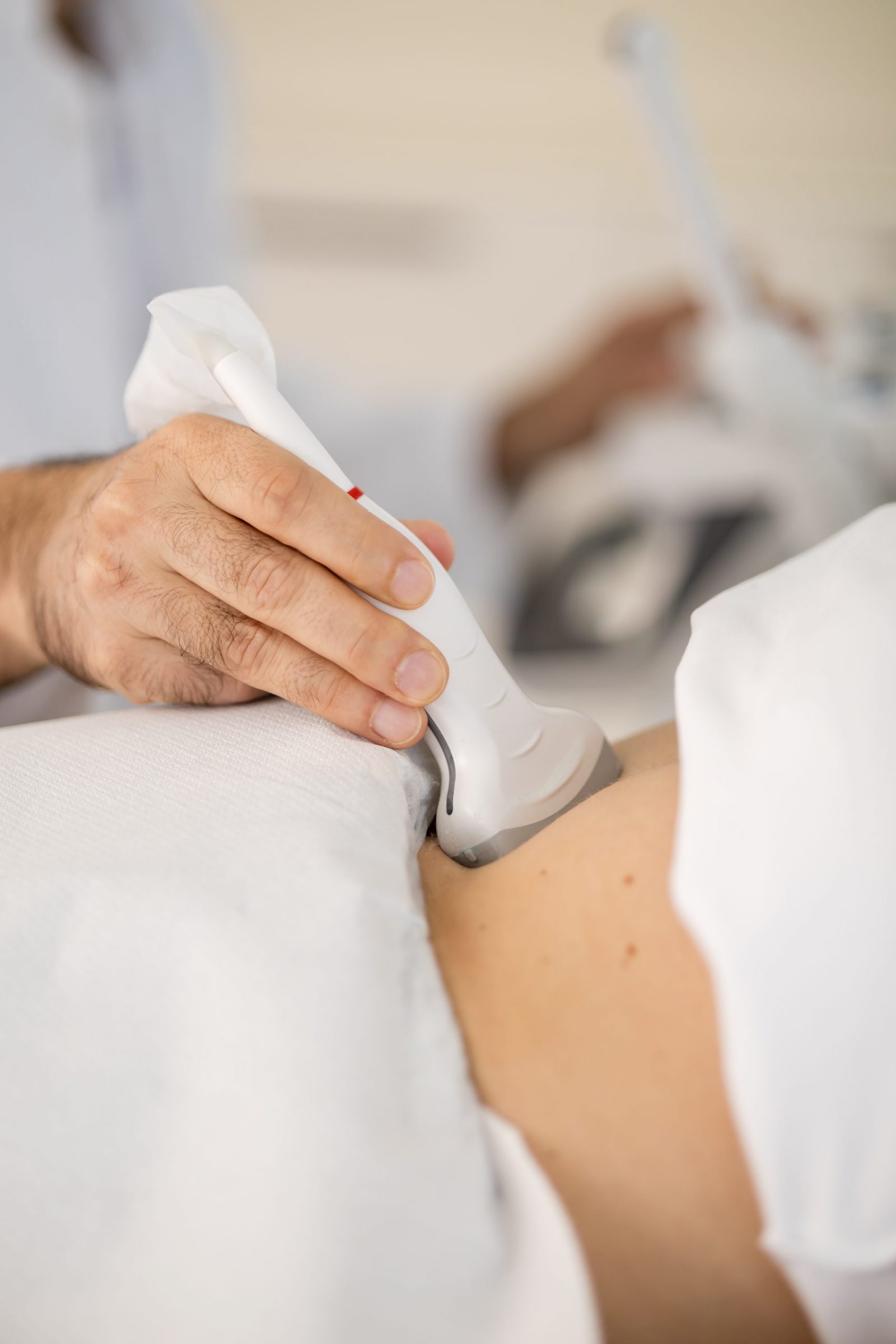 Krupni plan ruke zdravstvenog djelatnika koji ultrazvučnom sondom obavlja pregled pacijentova trbuha u ordinaciji.